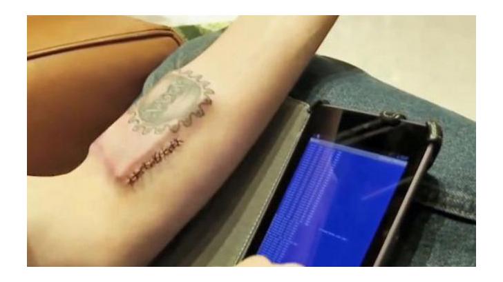 หนุ่มมะกันฝัง ชิปคอมพิวเตอร์ที่แขน หวังเป็น DIY Cyborg คนแรกของโลก