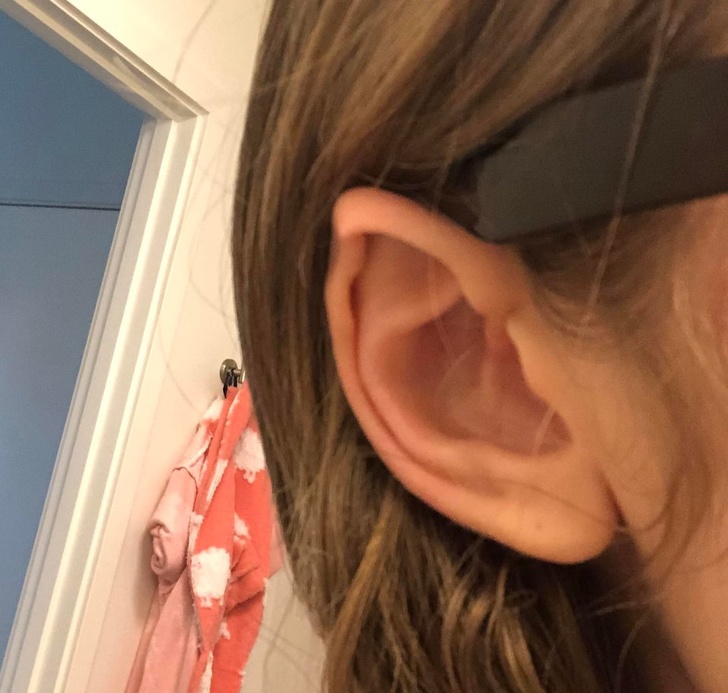 15 บุคคลที่มีเอกลักษณ์ที่โดดเด่น และดูไม่เหมือนใครจากความพิเศษของร่างกาย 15 บุคคลที่มีเอกลักษณ์ที่โดดเด่น และดูไม่เหมือนใครจากความพิเศษของร่างกาย