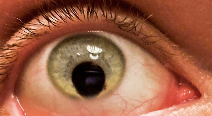 15 บุคคลที่มีเอกลักษณ์ที่โดดเด่น และดูไม่เหมือนใครจากความพิเศษของร่างกาย 15 บุคคลที่มีเอกลักษณ์ที่โดดเด่น และดูไม่เหมือนใครจากความพิเศษของร่างกาย