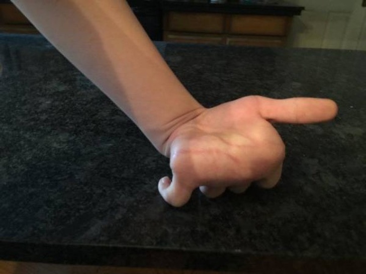 15 บุคคลที่มีเอกลักษณ์ที่โดดเด่น และดูไม่เหมือนใครจากความพิเศษของร่างกาย 15 บุคคลที่มีเอกลักษณ์ที่โดดเด่น และดูไม่เหมือนใครจากความพิเศษของร่างกาย