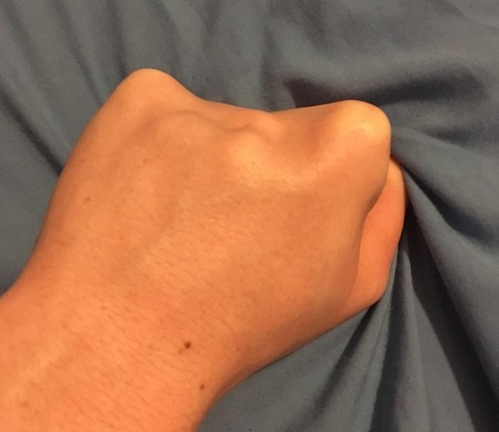 15 บุคคลที่มีเอกลักษณ์ที่โดดเด่น และดูไม่เหมือนใครจากความพิเศษของร่างกาย 15 บุคคลที่มีเอกลักษณ์ที่โดดเด่น และดูไม่เหมือนใครจากความพิเศษของร่างกาย