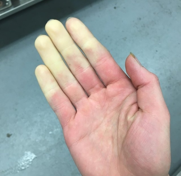 15 บุคคลที่มีเอกลักษณ์ที่โดดเด่น และดูไม่เหมือนใครจากความพิเศษของร่างกาย 15 บุคคลที่มีเอกลักษณ์ที่โดดเด่น และดูไม่เหมือนใครจากความพิเศษของร่างกาย