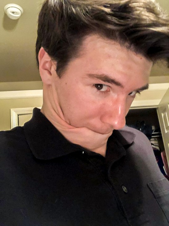 15 บุคคลที่มีเอกลักษณ์ที่โดดเด่น และดูไม่เหมือนใครจากความพิเศษของร่างกาย