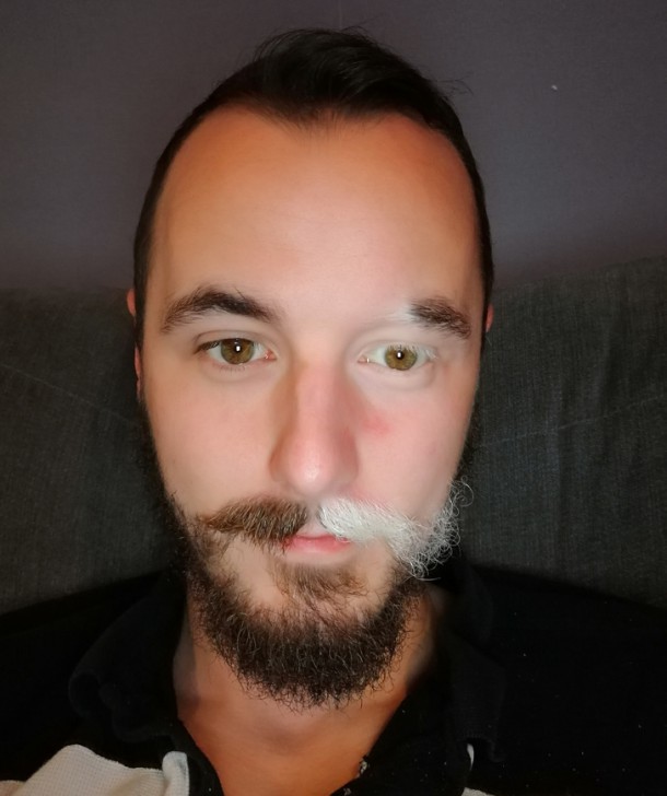 15 บุคคลที่มีเอกลักษณ์ที่โดดเด่น และดูไม่เหมือนใครจากความพิเศษของร่างกาย