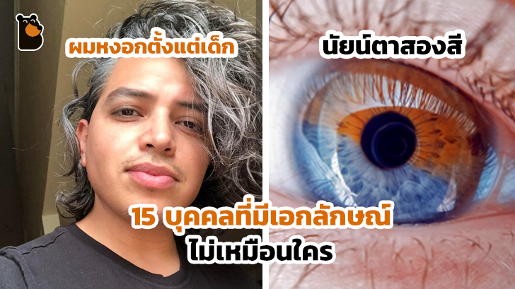 15 บุคคลที่มีเอกลักษณ์ที่โดดเด่น และดูไม่เหมือนใครจากความพิเศษของร่างกาย