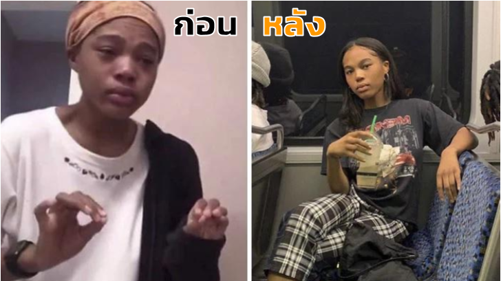 อย่าดูถูกคนแค่เพียงรูปลักษณ์ภายนอก เพราะคนเราเปลี่ยนแปลงได้ เมื่อหายจากโรคซึมเศร้า