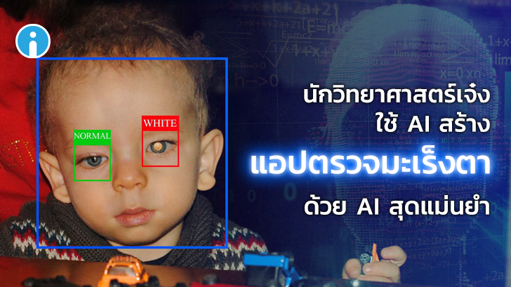 นักวิทยาศาสตร์ใช้ AI สร้างแอปฯ ที่สามารถตรวจหามะเร็งในดวงตาได้อย่างแม่นยำ