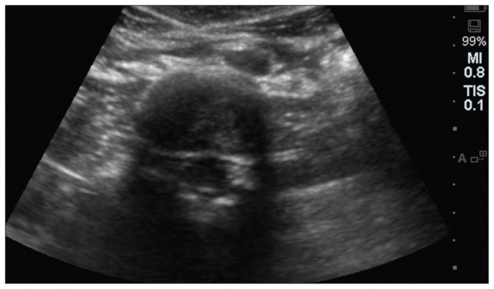 เคยสงสัยไหมว่าทำไมเราถึงมองเห็นสิ่งของต่างๆ มีหน้าตาประหลาดๆ? เคยสงสัยไหมว่าทำไมเราถึงมองเห็นสิ่งของต่างๆ มีหน้าตาประหลาดๆ?