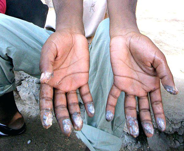 ลายนิ้วมือ (Fingerprint) คืออะไร ทำไมลายนิ้วมือคนเราต้องแตกต่างกัน ? ลายนิ้วมือ (Fingerprint) คืออะไร ทำไมลายนิ้วมือคนเราต้องแตกต่างกัน ?