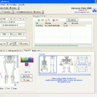 โปรแกรม บริหารจัดการ งานคลินิก คลินิกก้าวหน้า (AdvanceClinic)