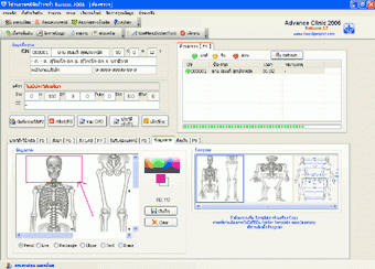 โปรแกรม บริหารจัดการ งานคลินิก คลินิกก้าวหน้า (AdvanceClinic) โปรแกรม บริหารจัดการ งานคลินิก คลินิกก้าวหน้า (AdvanceClinic)
