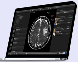 Image32 (โปรแกรมเก็บฟิล์มเอกซเรย์) : 