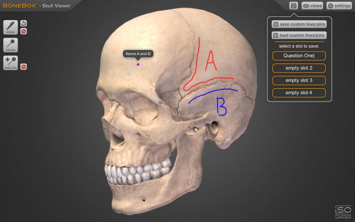 โปรแกรมดูกระดูกส่วนหัวกะโหลก BoneBox Skull Viewer