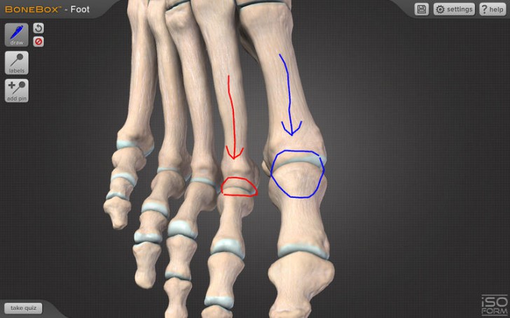 โปรแกรมดูกระดูกข้อต่อส่วนเท้า BoneBox Foot Viewer