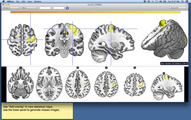 MRIcro (โปรแกรม MRIcro เปิดไฟล์รูปภาพทางการแพทย์ MRI บน Mac) : 