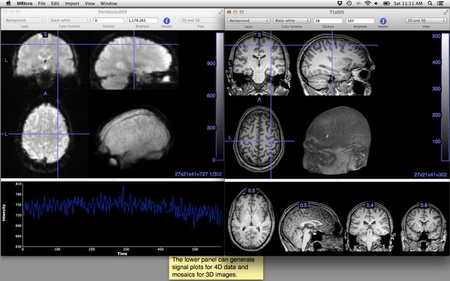 โปรแกรมเปิดไฟล์รูปทางการแพทย์ MRIcro