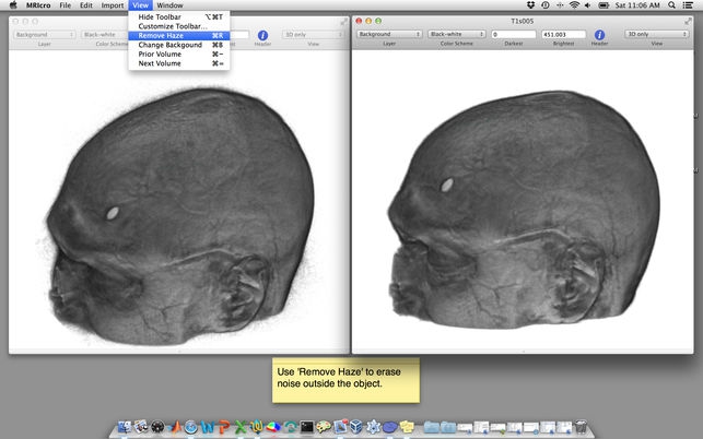 MRIcro (โปรแกรม MRIcro เปิดไฟล์รูปภาพทางการแพทย์ MRI บน Mac) : 