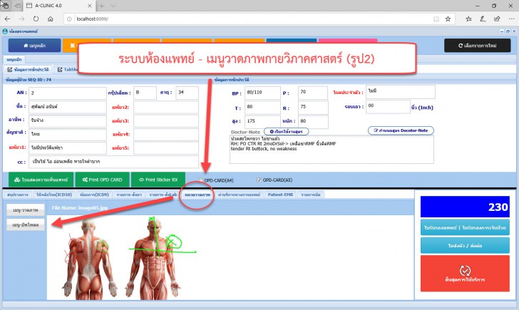 A-CLINIC (ระบบบริหารงานคลินิกรักษาโรค แบบครบวงจร ใช้งานผ่านเว็บไซต์) : 