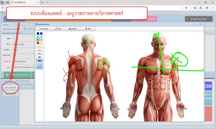 โปรแกรมบริหารงานคลินิกทั่วไป A-CLINIC